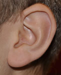 Opgave 12 / 20 Nogle mennesker har en tilhæftet øreflip: Andre mennesker har en fri øreflip: (Begge fotos: Keld Nørgaard) Egenskaben tilhæftet øreflip / fri øreflip er knyttet til et enkelt par gener.