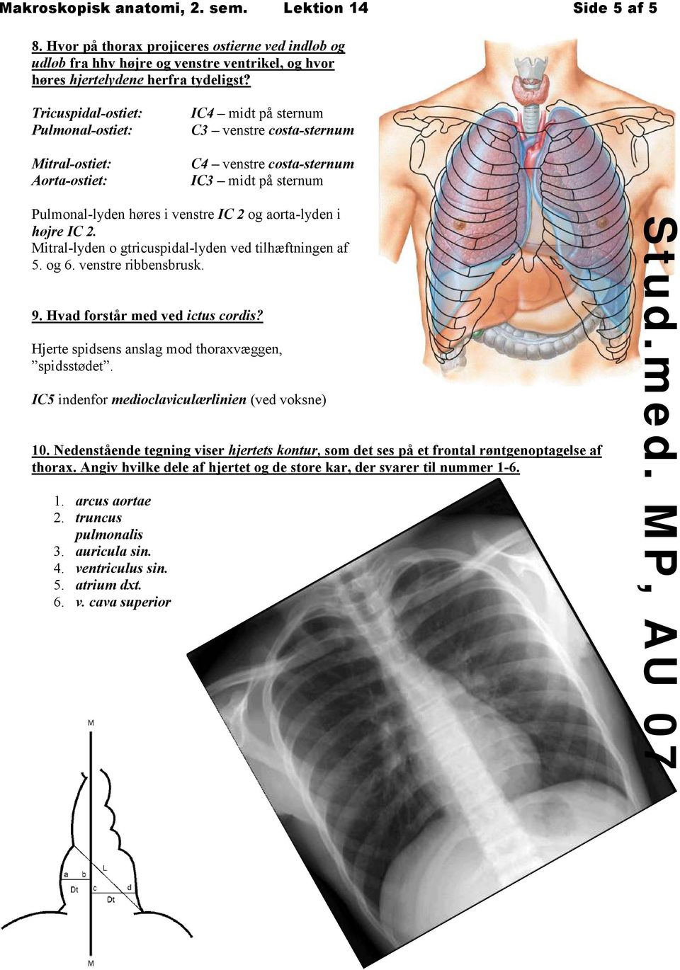 aorta-lyden i højre IC 2. Mitral-lyden o gtricuspidal-lyden ved tilhæftningen af 5. og 6. venstre ribbensbrusk. 9. Hvad forstår med ved ictus cordis?
