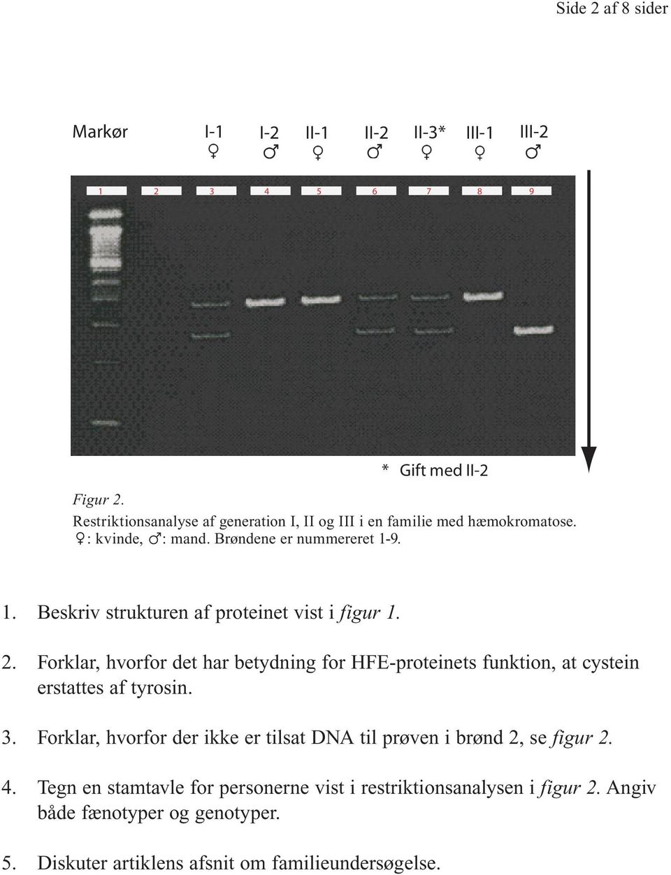 9. 1. Beskriv strukturen af proteinet vist i figur 1. 2. Forklar, hvorfor det har betydning for HFE proteinets funktion, at cystein erstattes af tyrosin. 3.