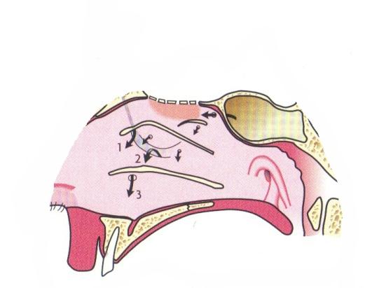 1. a) Beskriv opbygningen af den ydre næse. b) Angiv den sensoriske innervation af den ydre næses hud.