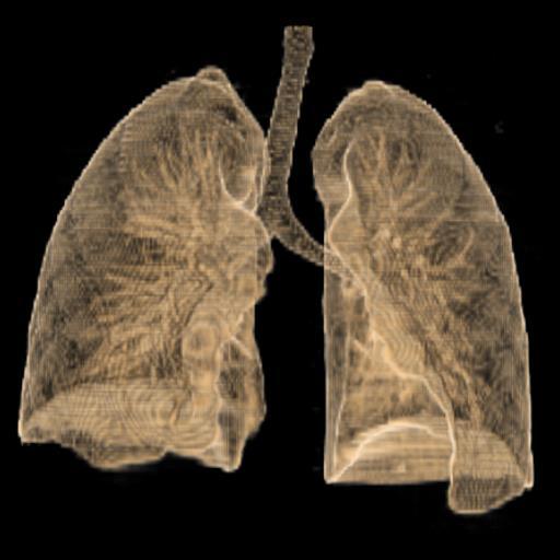 Lungernes topografi og relationer: CT 3D Apex pulmonis. Basis pulmonis.