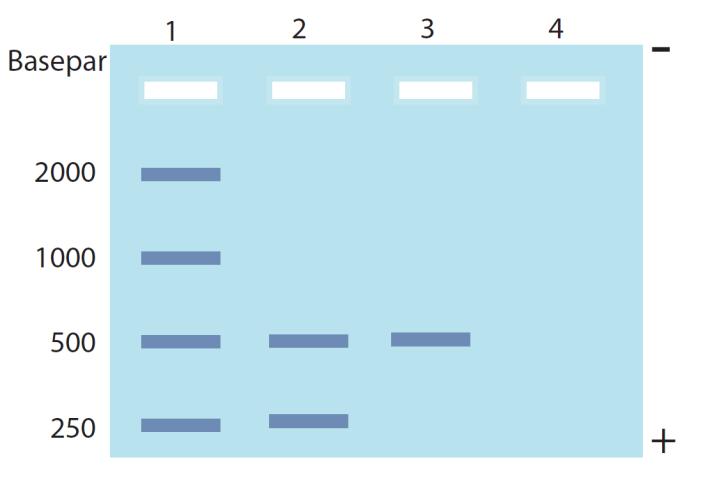 Figur 4.2. Gel af elektroforese af PCR-produkter. Bane 1, Størrelsesmarkør; Bane 2-4, Patienter. 3. Forklar resultaterne vist i figur 4.2. Det viser sig, at klamydia kan stamme fra forskellige genetiske varianter af Chlamydia-bakterien.