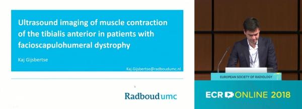 New fields of pathologies Ultrasound imaging of muscle contraction of the tibialis