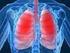 En undersøgelse af patienter med Kronisk Obstruktiv Lungesygdom
